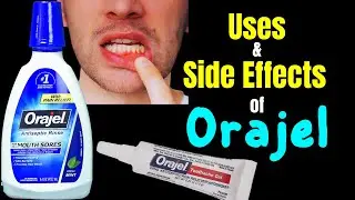 Orajel – Side Effects, Uses, Mechanism of Action, Dosage, Interactions, Warnings