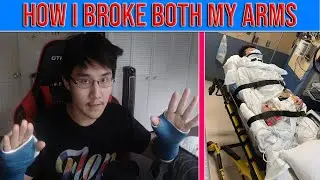 How I Broke Both Of My Arms