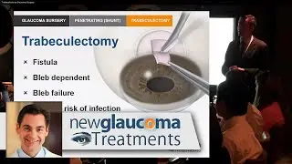 Trabeculectomy Glaucoma Surgery