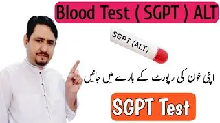 SGPT : ALT Blood Test in Urdu Hindi || SGPT Normal Range Treatment & Diet || Irfan Azeem