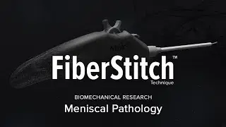 FiberStitch™ Implant Biomechanical Research: Meniscal Pathology