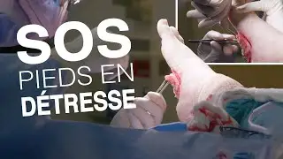 SON PIED EST UNE HORREUR !