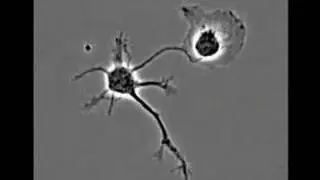 A normal neuron and a mutated neuron develop side by side.