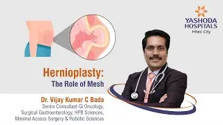 Hernioplasty: The Role of Mesh | Yashoda Hospitals Hyderabad