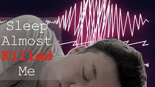 A Sleep Study in My 20s Saved My Life