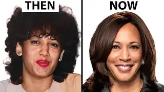 Kamala Harris NEW FACE | Plastic Surgery Analysis