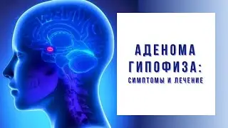 Аденома гипофиза: причины, симптомы, операция и лечение