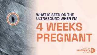 What does the 4 Week Pregnancy Scan look like? A London Pregnancy Clinic case study