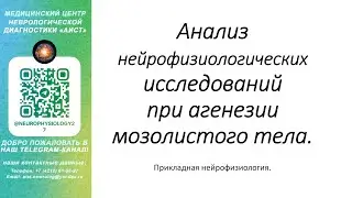 Тема: Анализ нейрофизиологических исследований при агенезии мозолистого тела.