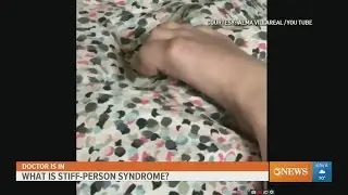 What is stiff person syndrome? The doctor is in.