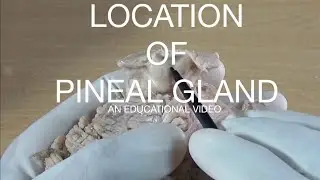 LOCATION OF PINEAL GLAND - AN EDUCATIONAL VIDEO