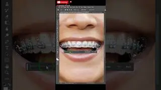 How to Remove Braces with Ai in Photoshop 🦷🦷