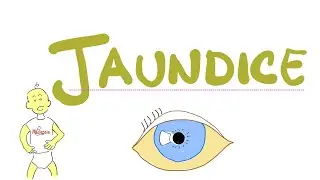 Jaundice Lab Tests - Urine Bilirubin & Urobilinogen - How to diagnose jaundice (icterus)