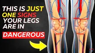 TAKE ACTION NOW! 7 Common Signs You Have Poor Leg Circulation Without Knowing!