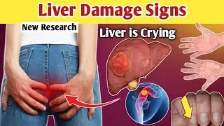 LIVER is Crying! 10 Strange Signs and Symptoms of LIVER Damage and LIVER Disease