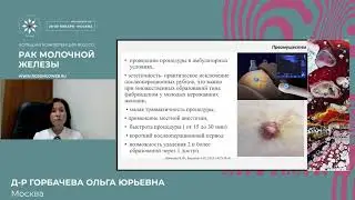 Современные подходы к лечению фиброаденомы