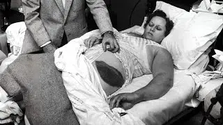 The Only Person in History to Have Been Struck by a Meteorite