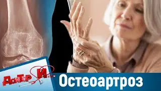 Борьба с остеоартрозом. “Доктор И“