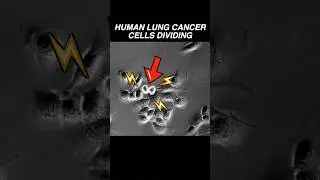 Human lung cancer cells dividing RAPIDLY! 