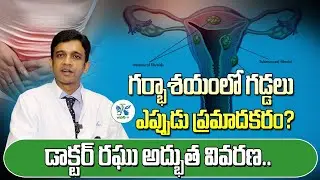 గర్భాశయంలో గడ్డలు ఎప్పుడు ప్రమాదకరం? | Uterine Fibroids Causes, Treatment, and Prevention in Telugu