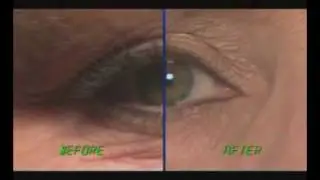 Skin Doctors Instant Facelift