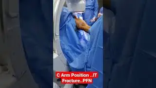 C Arm Position ..IT Fracture..PFN..Dr Sai Chandra