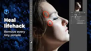 Retouch4me Heal plugin Hack: How to remove ALL pimples