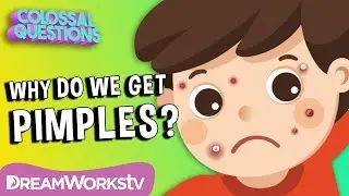 Why Do We Get Pimples? | COLOSSAL QUESTIONS | Learn #withme