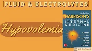 HYPOVOLEMIA | Causes |  Diagnosis | Treatment | Harrison