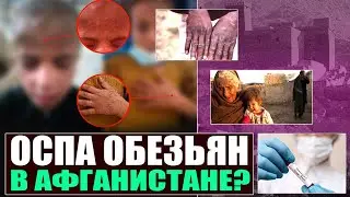 ОСПА ОБЕЗЬЯН ДОБРАЛАСЬ ДО АФГАНИСТАНА?