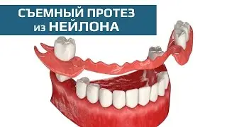 Съемные зубные протезы: нейлоновый зубной протез