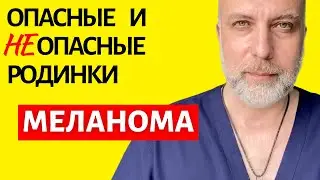 Когда ваши родинки опасны? Что такое меланома кожи и как самостоятельно обнаружить ее у себя