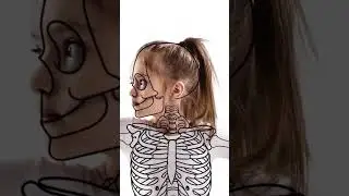 СКЕЛЕТ У ДЕТЕЙ КРУЧЕ 
