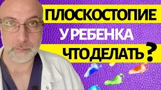 Как лечить плоскостопие у детей? Доктор Елизаров | Вопрос доктору