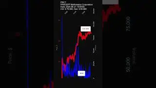 PRCT, PROCEPT BioRobotics Corporation, 2024-08-21, stock prices dynamics, stock of the day #PRCT