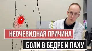 Грыжа межпозвонкового диска L3-L4. Клинический разбор с МРТ и подбором лечения