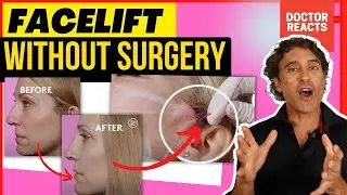 THREAD LIFT PROCEDURE With BEFORE and AFTER INTERVIEW // Dr Rajani REACTS