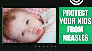 How to Protect Your Children From Measles Outbreak