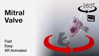 360 video - Mitral Valve - Explained in Mixed Reality