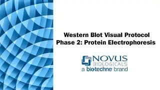 Western Blot Visual Protocol: Phase 2: Protein Electrophoresis (SDS-PAGE)