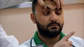 4th cranial nerve examination