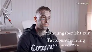 Erfahrungsbericht zur Tattooentfernung bei Dermacare Wien