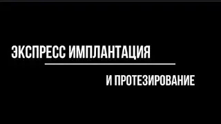 экспресс имплантация и протезирование