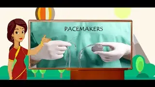 PACEMAKERS