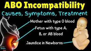 ABO Incompatibility in Newborns | ABO Incompatibility in Pregnancy – Causes, Symptoms & Treatments