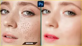 High End Retouching ।  Face Retouching in Photoshop