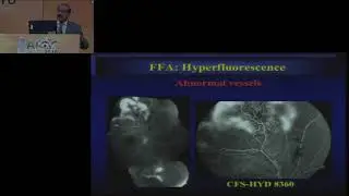 AIOC2018 - GP161 -Topic - FFA, OCT - An Interactive, (30 min)