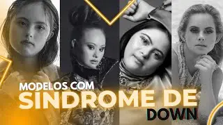 Personalidades que  Fazem História!!!!! - Modelos com Síndrome de Down