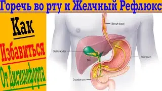 Горечь и белый налёт во рту! Как избавиться от желчного рефлюкса!