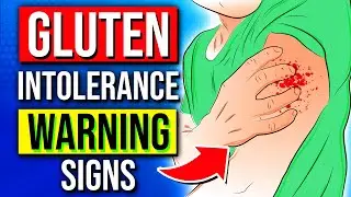 17 Warning Signs That You Have A Gluten Intolerance